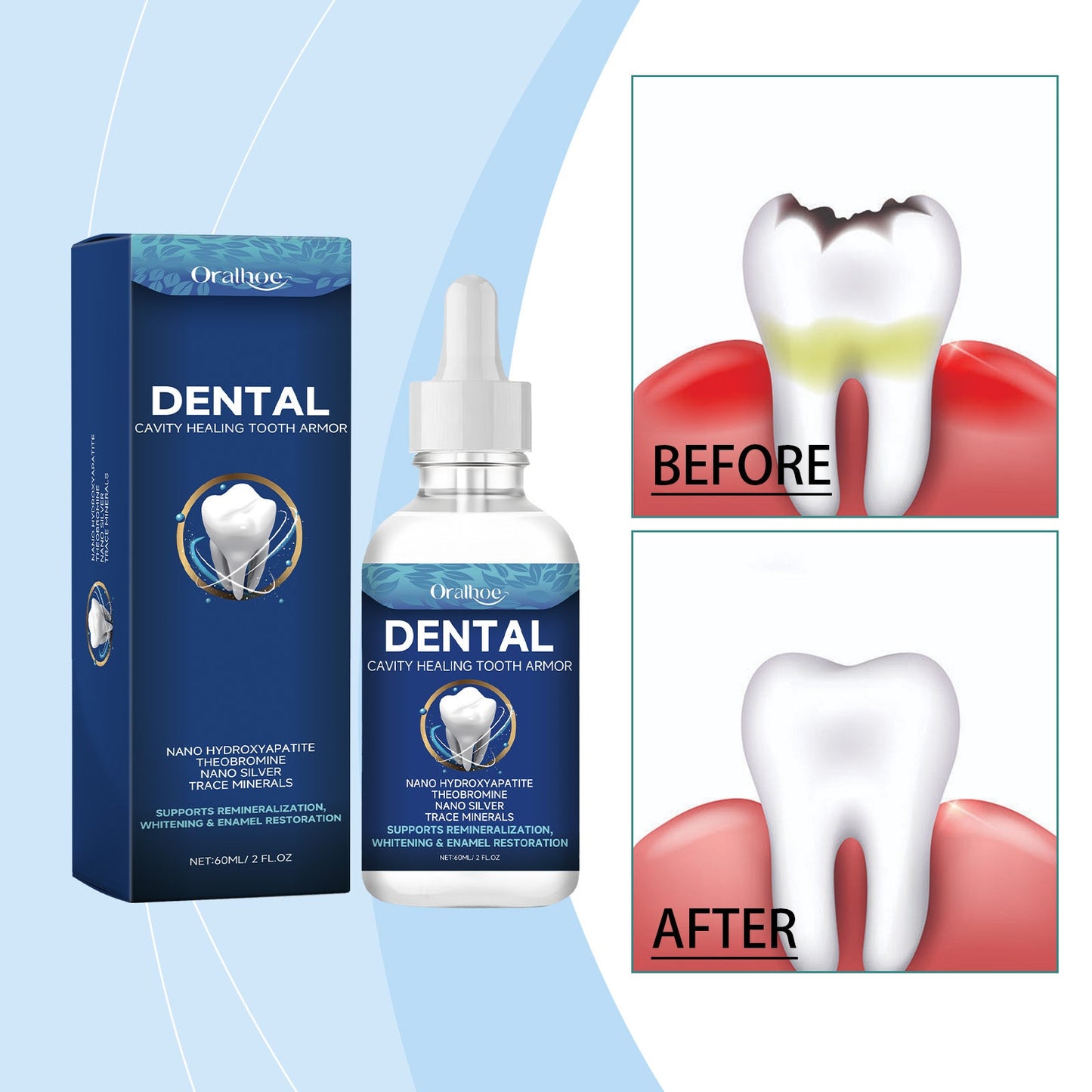 Tooth Care Solution