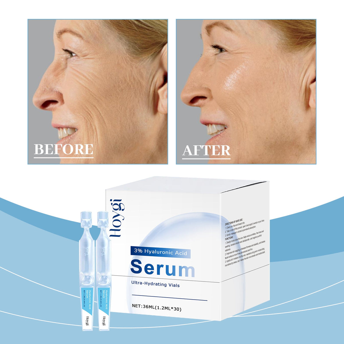 Hyaluronic Acid Anti Wrinkle E Ssence 1.2mlx30 1box