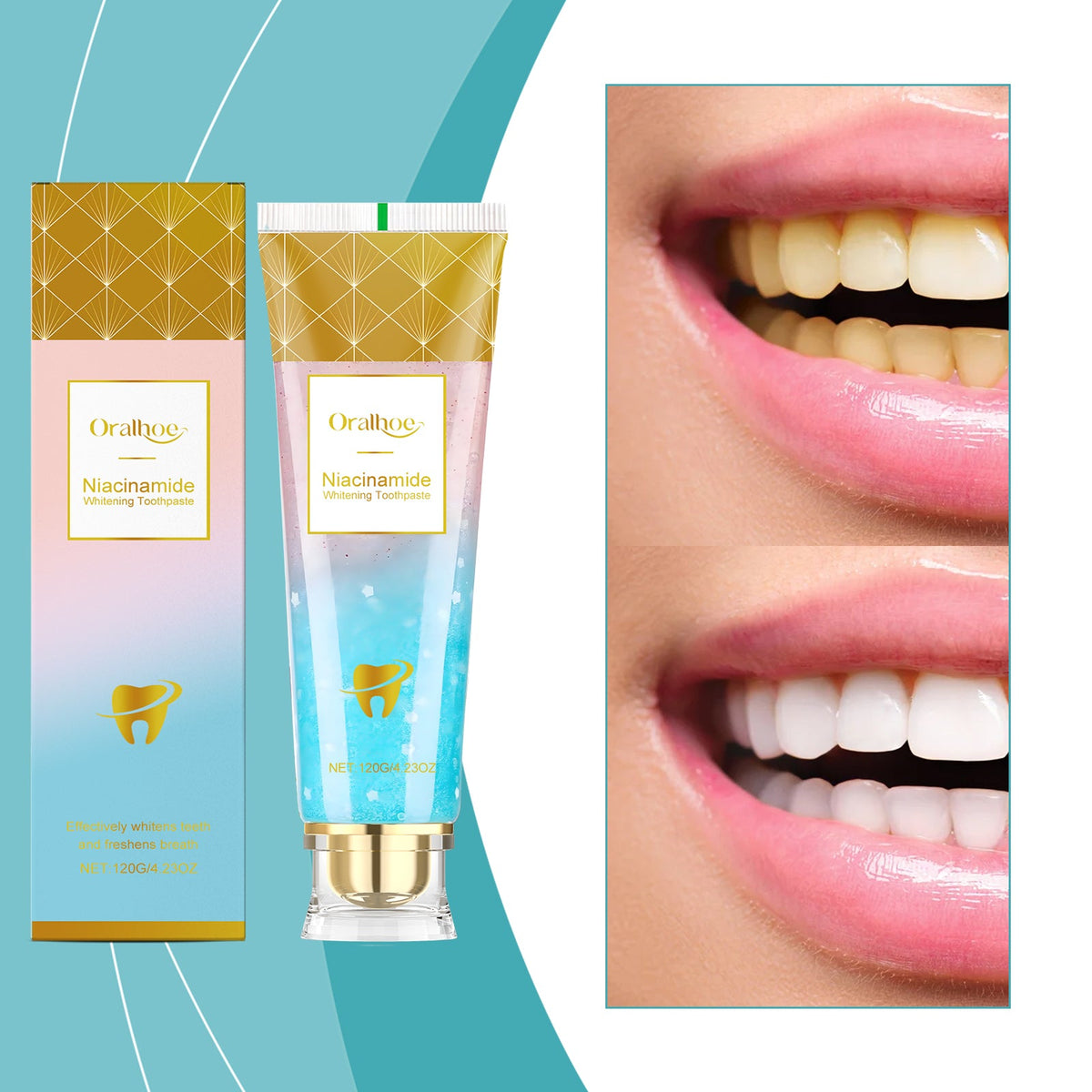 Niacinamide Whitening Toothpaste 120g-box