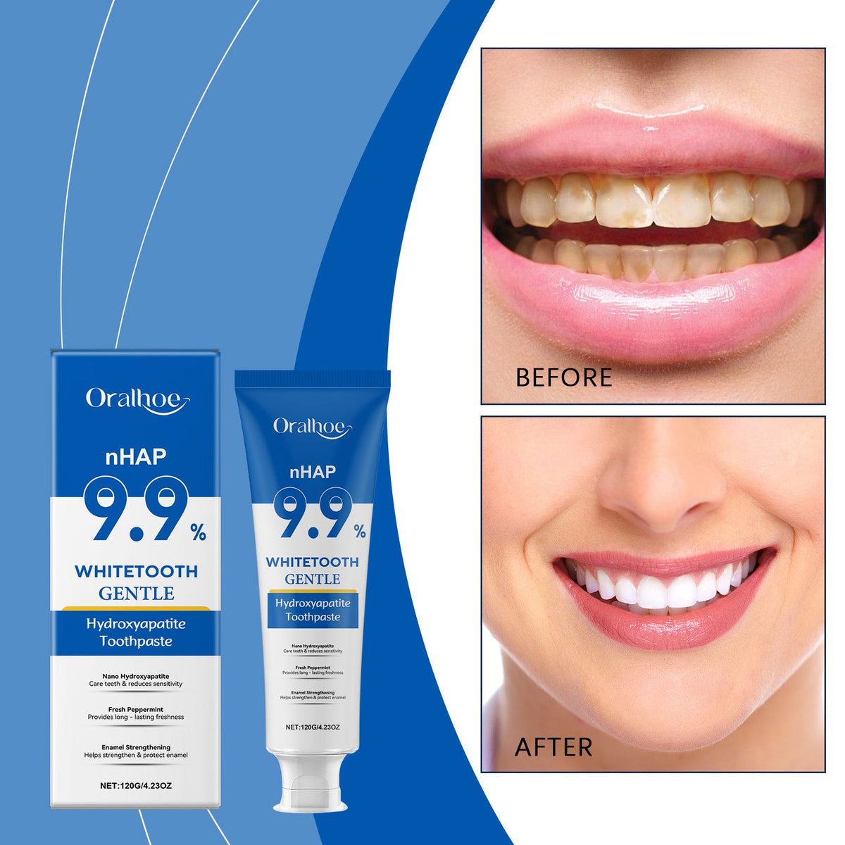 Gentle Mint Whitening Toothpaste 120g  1box