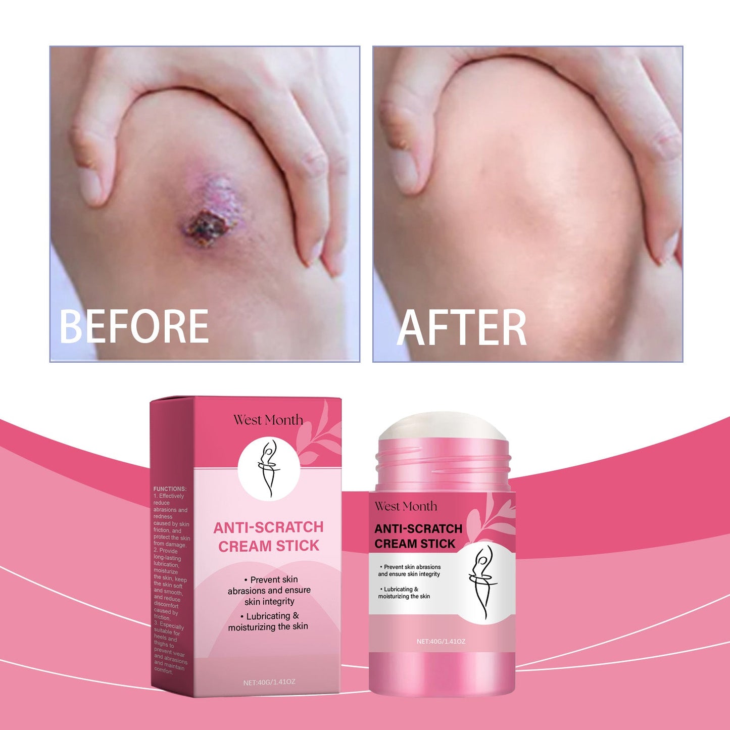 Body Anti Scratch Moisturizing Stick 40g 1 Box