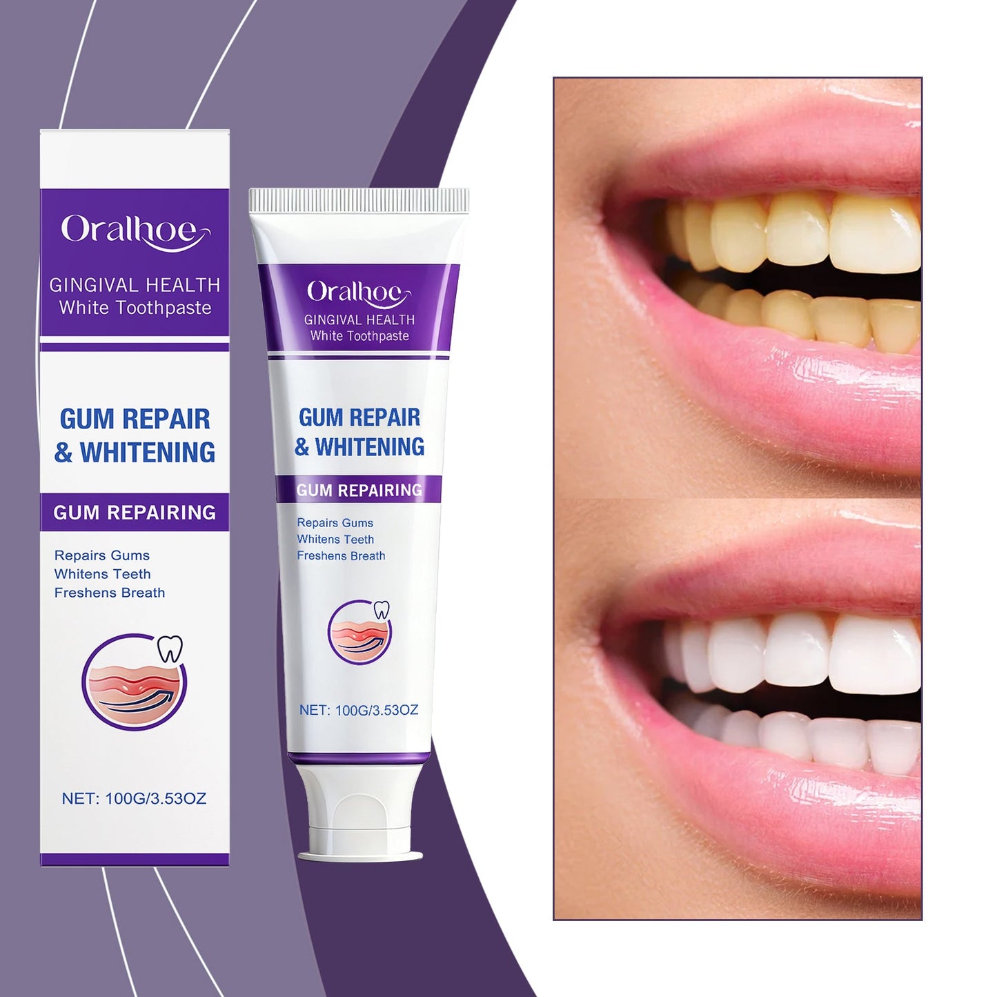 Brightening & Gum Care Repair Toothpaste 1 00g