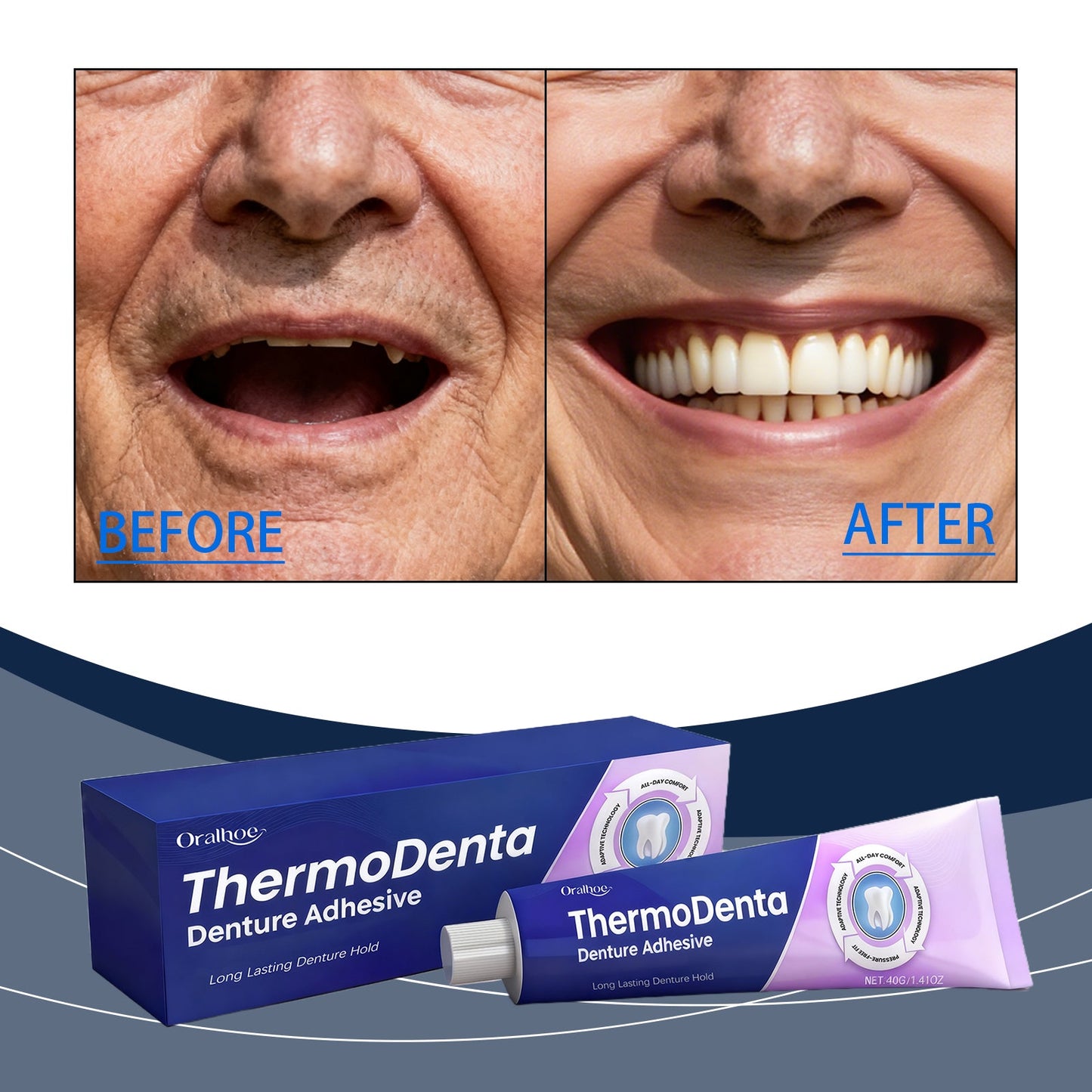 Permanent Denture Adhesive
