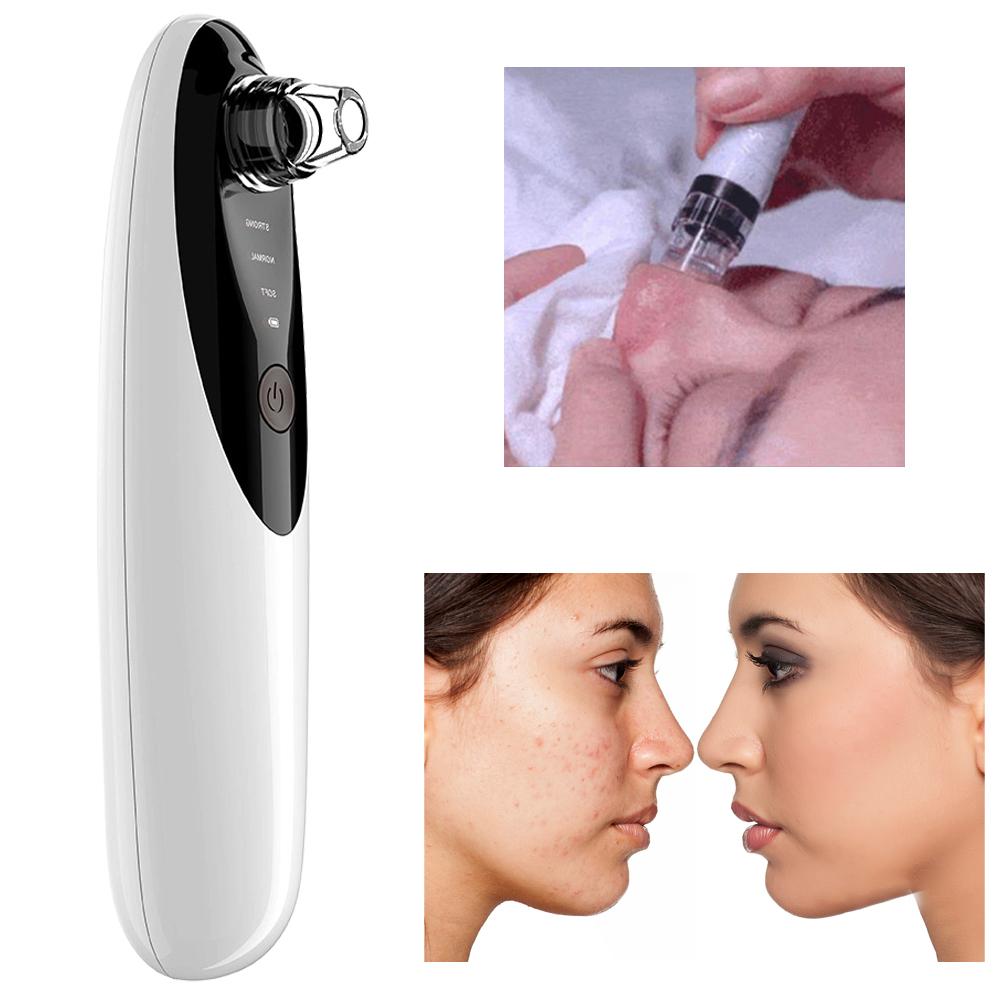 10X Microscope Electric Blackhead Remover Camera Wifi Wireless SP