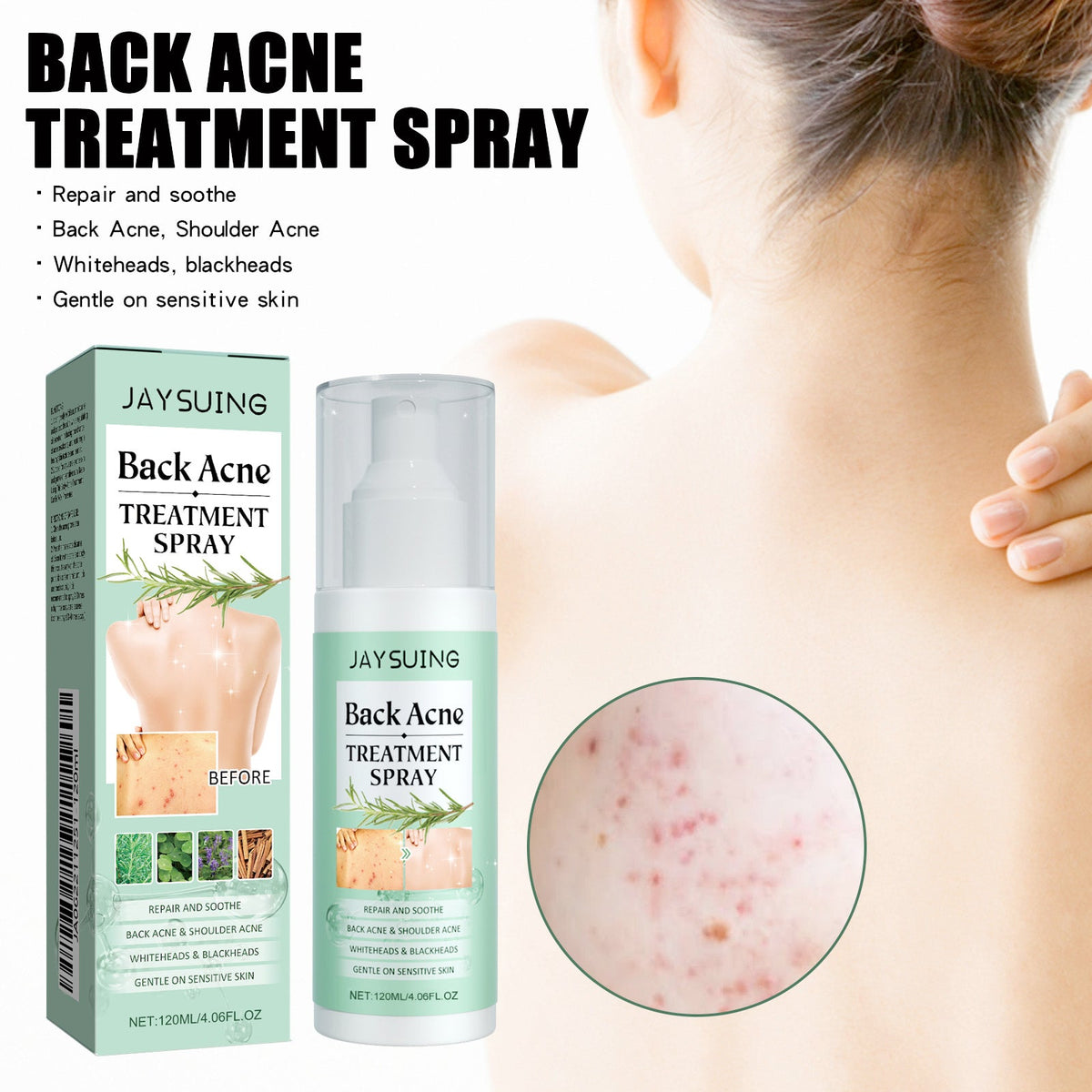 Back Cleansing Spray 120ml 1 Box