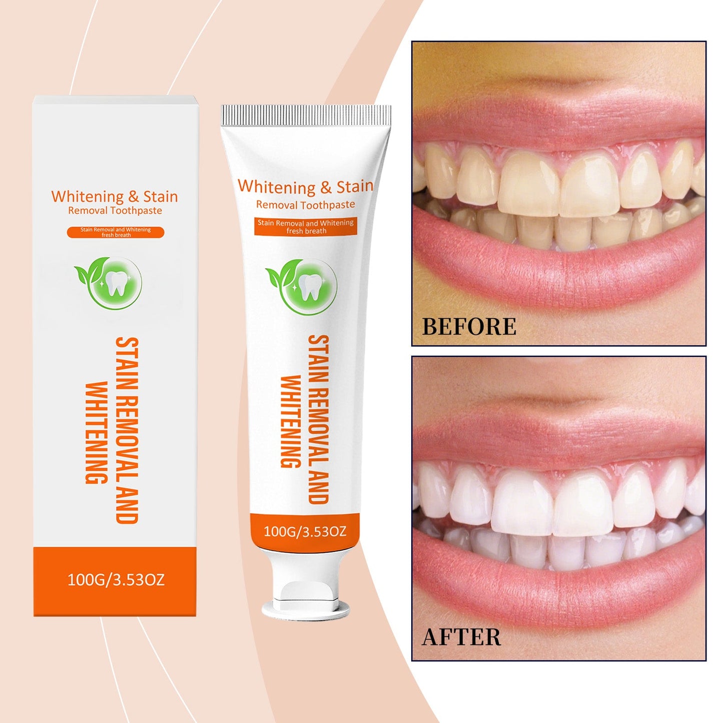 Gentle Whitening Toothpaste 1 00g  1box