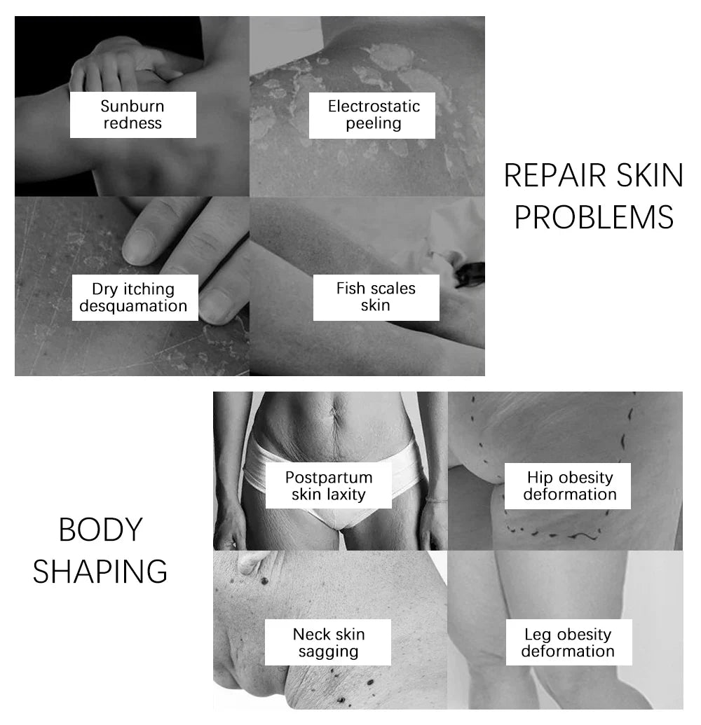 Yoxier Pearl Firming Body Lotion Slimming Cellulite Massage Remove Stretch Marks Cream Treatment Body Skin Care Health Lift Tool