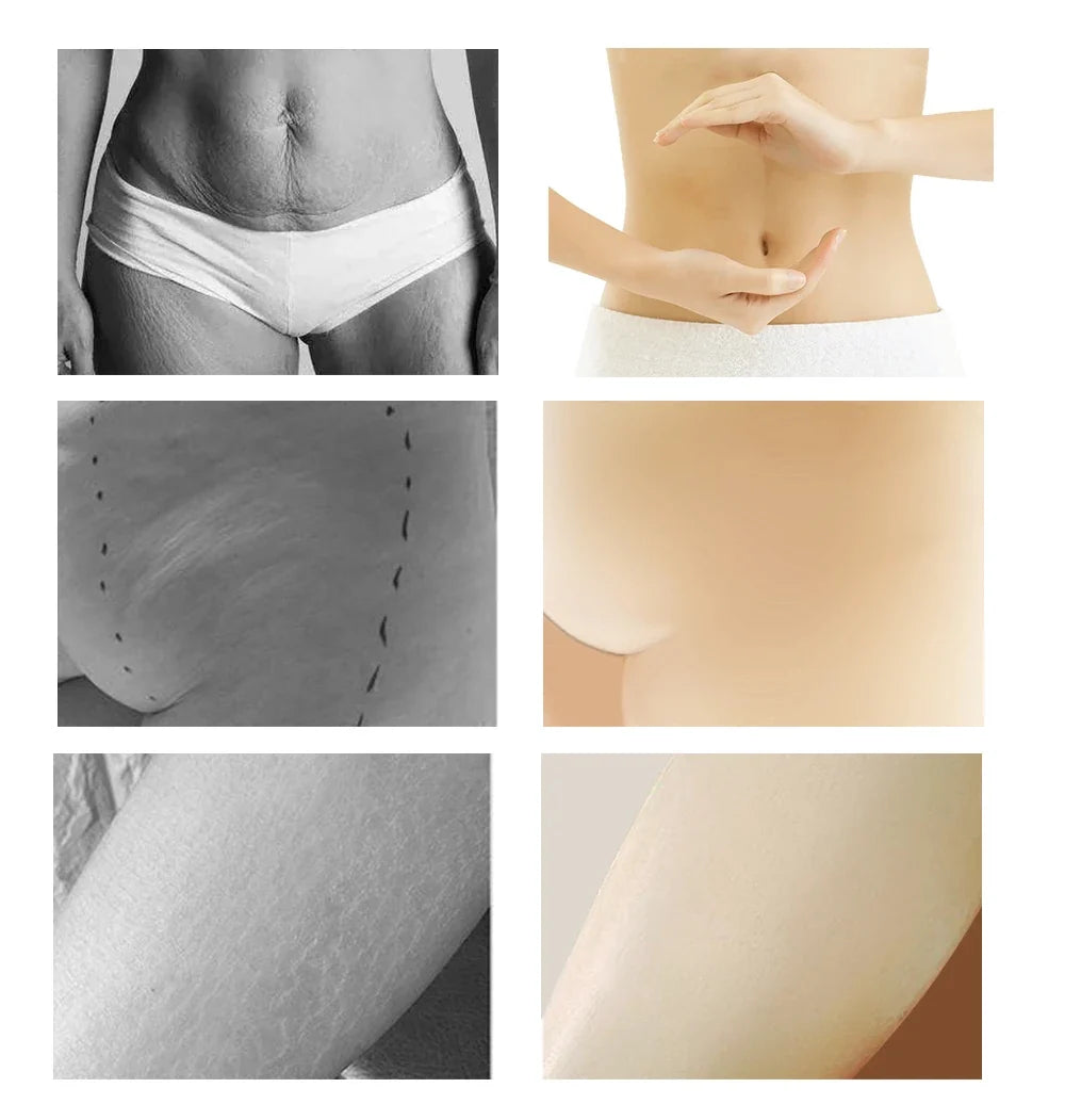 Yoxier Pearl Firming Body Lotion Slimming Cellulite Massage Remove Stretch Marks Cream Treatment Body Skin Care Health Lift Tool
