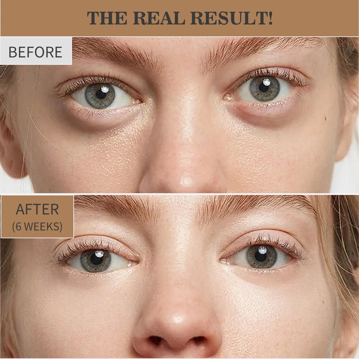 Retinol Eye Cream Anti Wrinkles,Anti Puffiness Remove Dark Circle Eye Bag Hyaluronic Acid Moisturize Peptides Soothe Skin Care