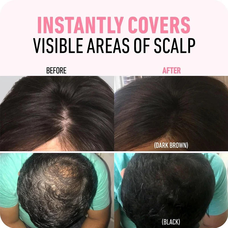 Hairline Powder Instantly Conceals Hair Root Touch Hair Powder for Thinning Hair for Women and Men,Hairline Shadow Powder Makeup