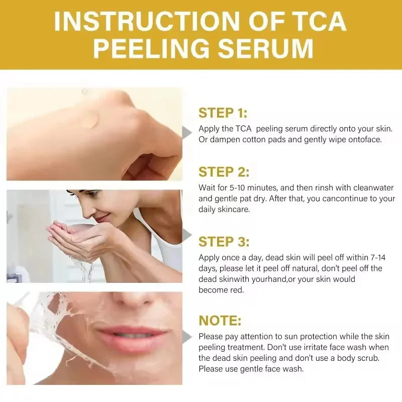 Acid Peeling Serum Chemical Exfoliant Peel For Remove Face Dark Skin Spots Whiten Lighten Melanin Peeling Solution Skin Peel