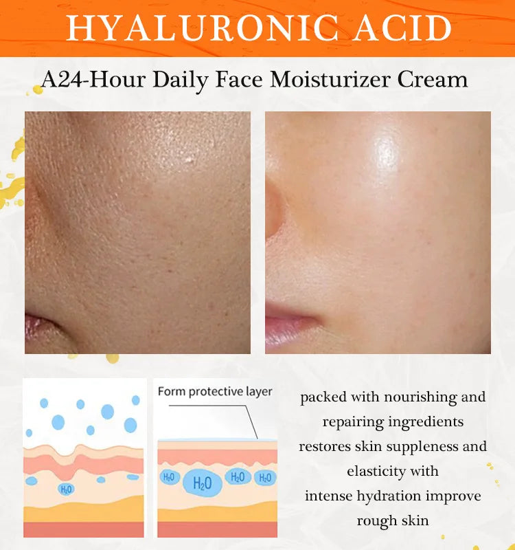 JoyPretty Vitamin C Face Cream Whitening Hyaluronic Acid Moisturizing Dark Spot Remover Brightening Facial Cream Skin Care 50g