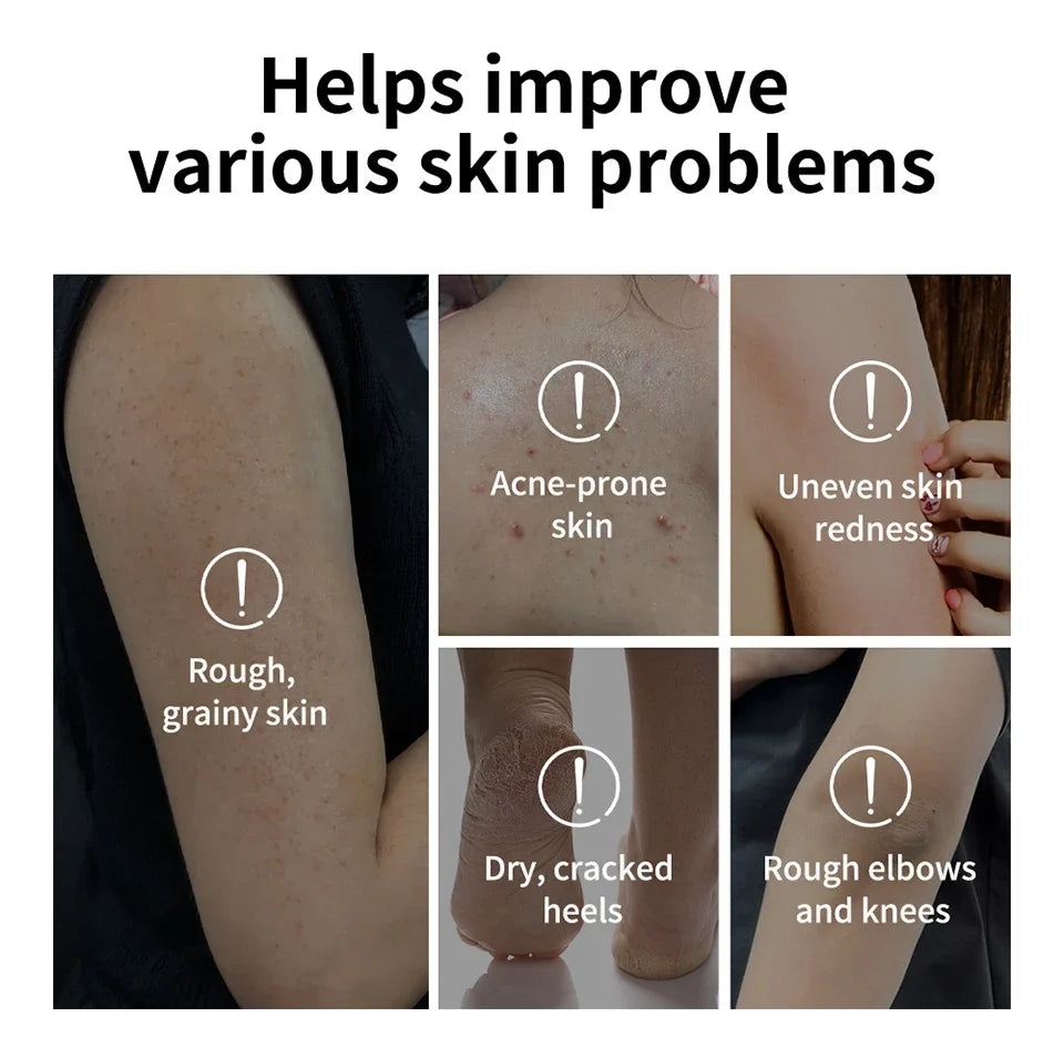 Glycolic Acid Exfoliating Body Stick Multiple Concerns Delivers Deep Effective Exfoliation Nourishing Moisture Deep Hydration