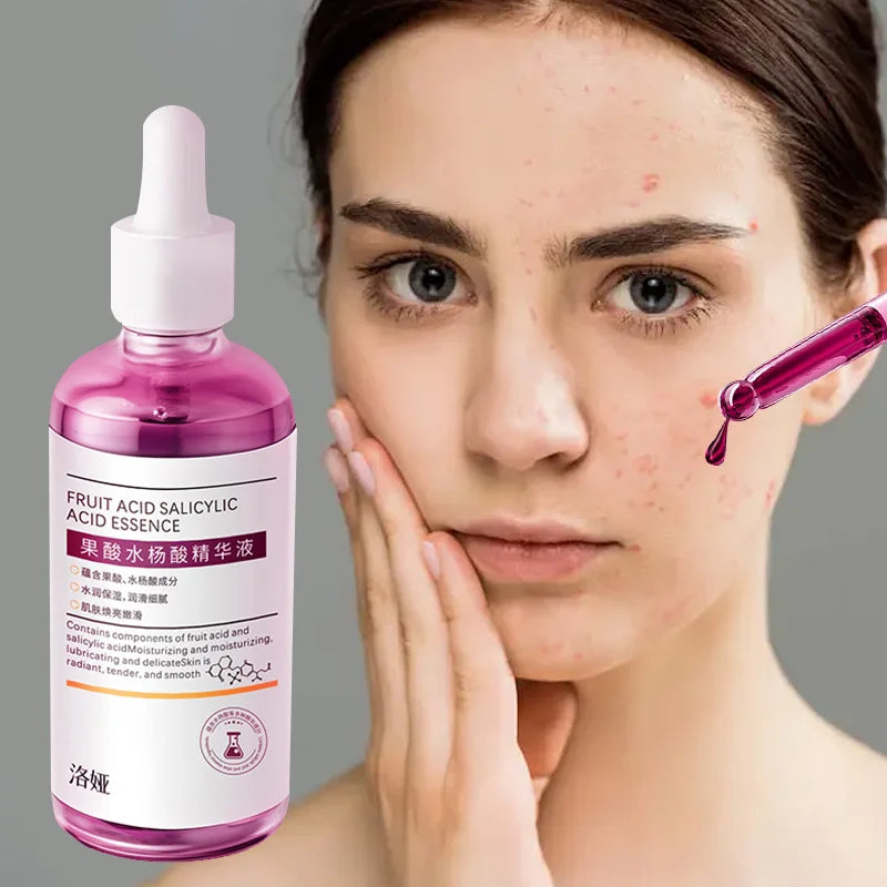 100ml Pink Salicylic Acid Acne Removing Concentrated essence - Refreshing texture, deep moisturizing, fade acne marks