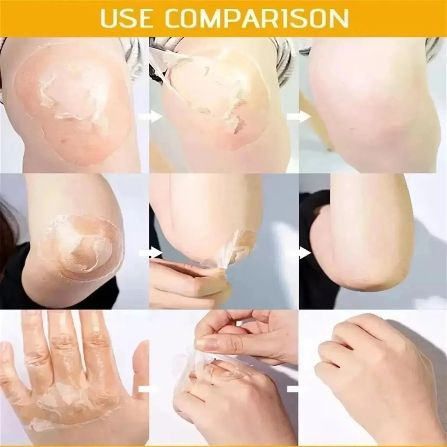 Acid Peeling Serum Chemical Exfoliant Peel For Remove Face Dark Skin Spots Whiten Lighten Melanin Peeling Solution Skin Peel
