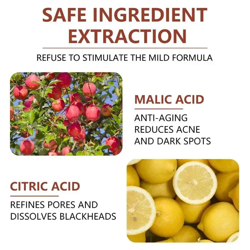 Acid Peeling Serum Chemical Exfoliant Peel For Remove Face Dark Skin Spots Whiten Lighten Melanin Peeling Solution Skin Peel