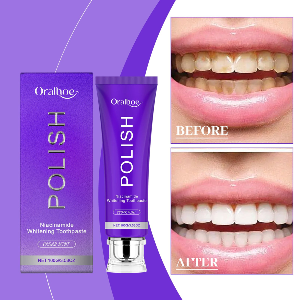 Bright White F Resh Breath Toothpaste 1 0 0g  1box