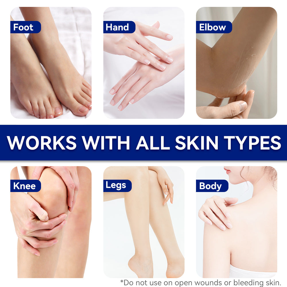 ETEB Urea Cream Moisturizing Vitamin E Cream Body Lotion Hand And Foot Care For Dry Hands And Feet