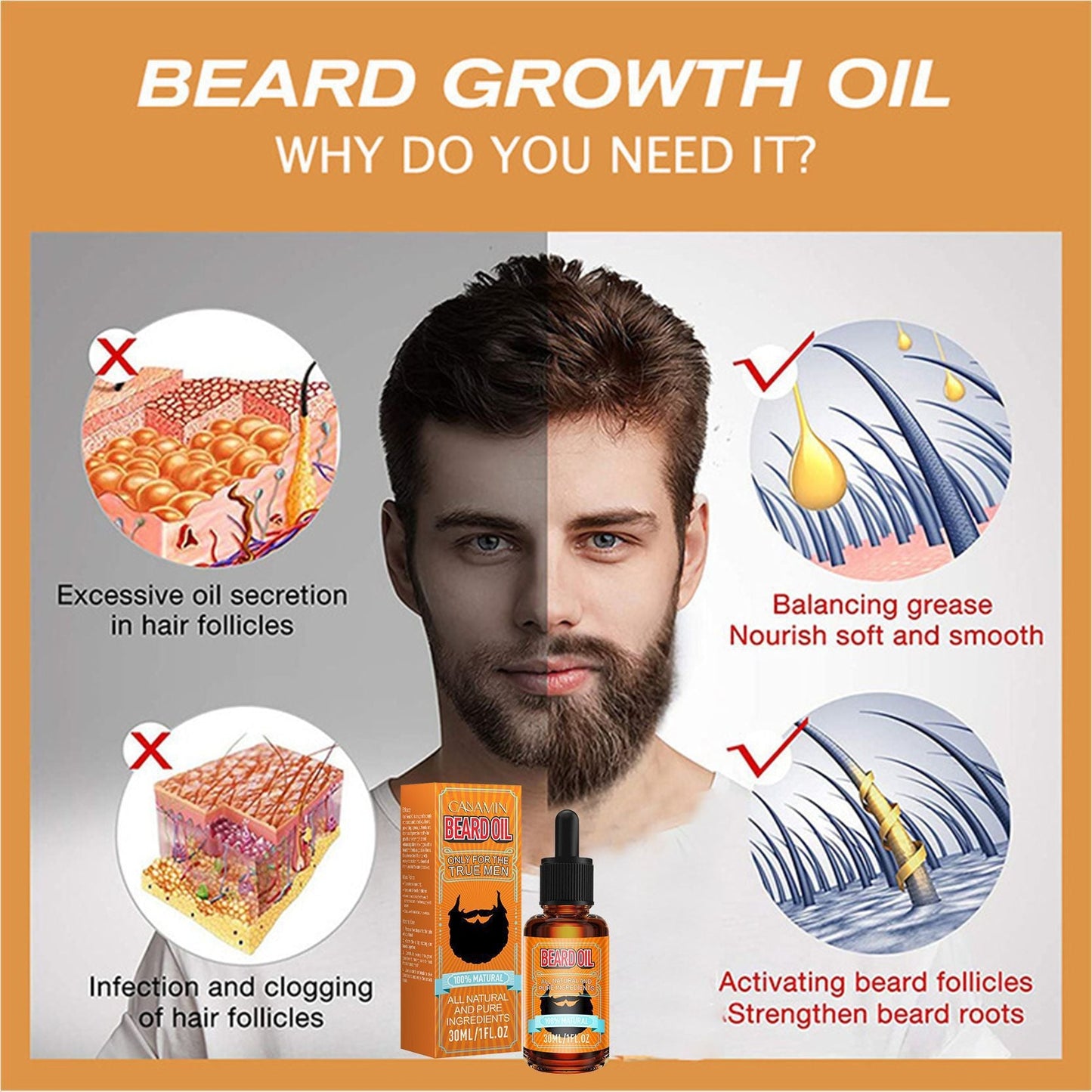 CANAMIN Beard Growth Liquid 30ml