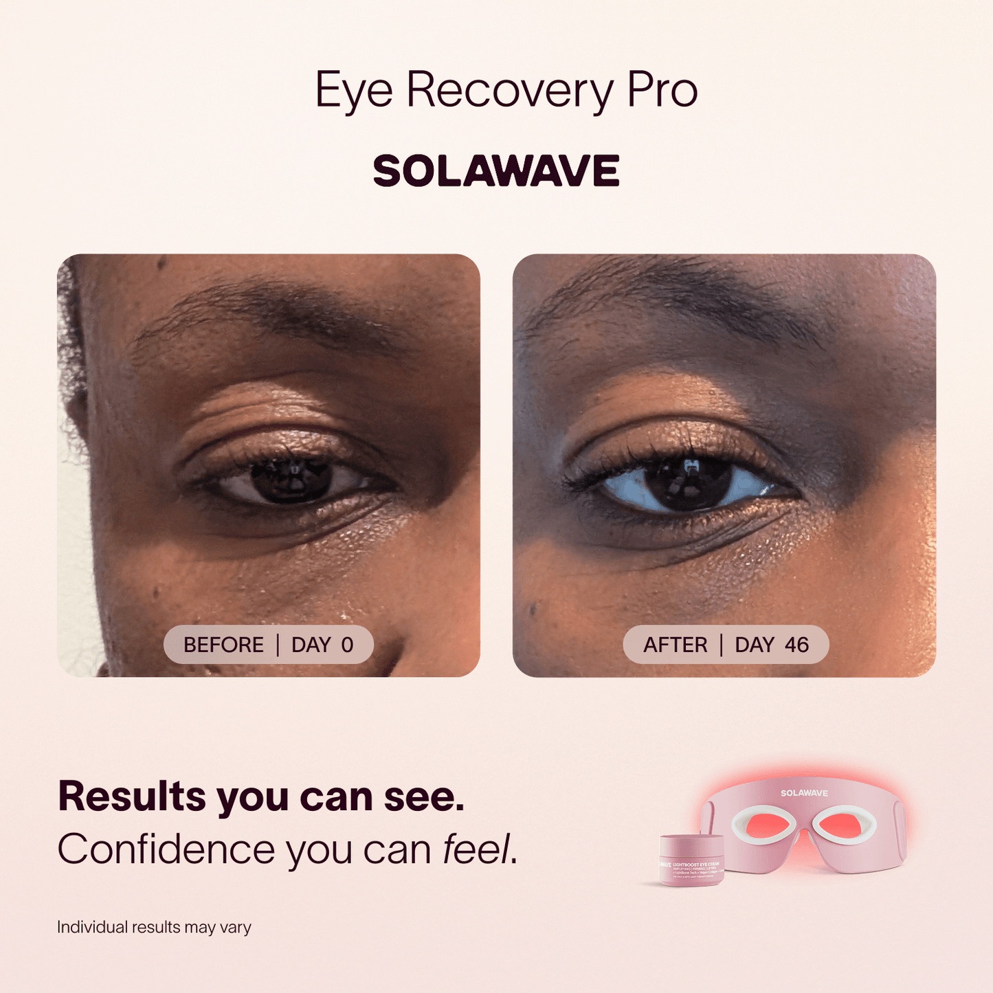 Eye Recovery Pro Kit